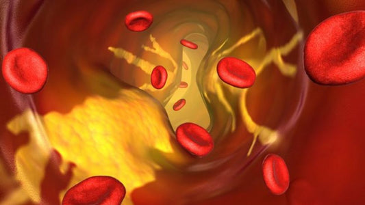 Your Cholesterol and TGs